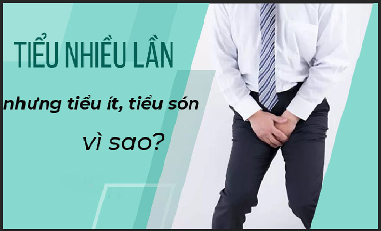 Đi tiểu liên tục là bệnh lý gì ? Nguyên nhân và cách điều trị hiệu quả