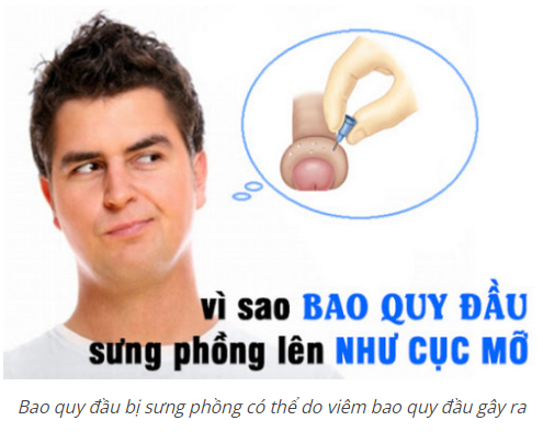 Sưng đau bao quy đầu là dấu hiệu bệnh gì ? Nguyên nhân và cách điều trị