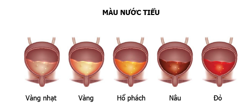 Nước tiểu có màu bất thường  phải làm sao ?