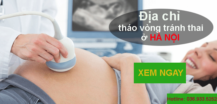 Tìm hiểu về địa chỉ tháo vòng tránh thai hết bao nhiêu tiền tại Hà Nội?